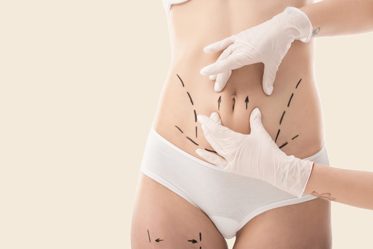 How To Prepare For Cosmetic Surgery